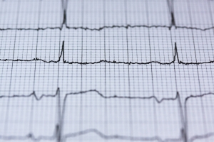 O consumo leve e moderado de álcool pode diminuir o risco de doenças cardiovasculares?